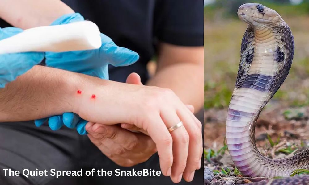 The Quiet Spread of the SnakeBite